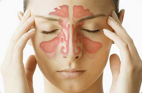 Chronic sinus infection